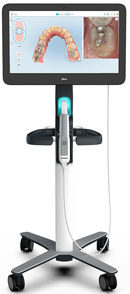 iTero™ Digital Impressions iTero™ Digital Impressions