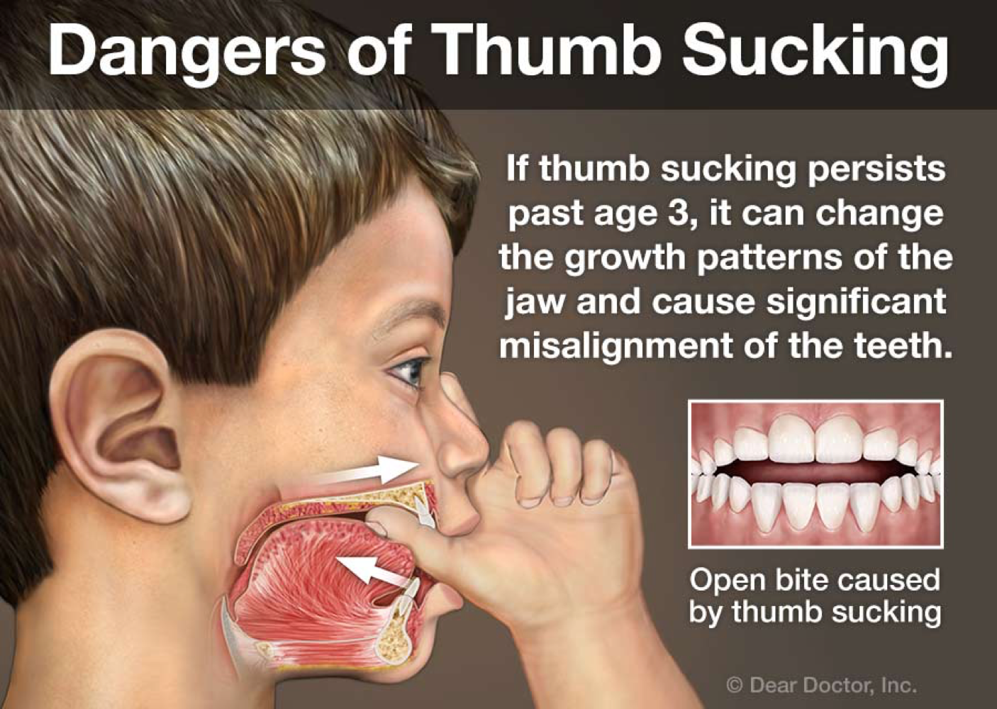 Orthodontist early treatment
