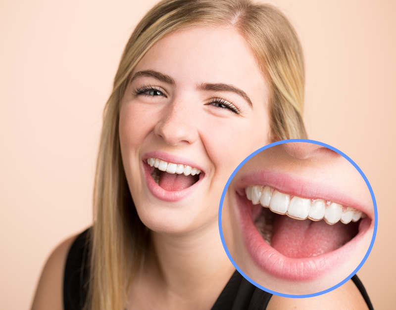 Retainer