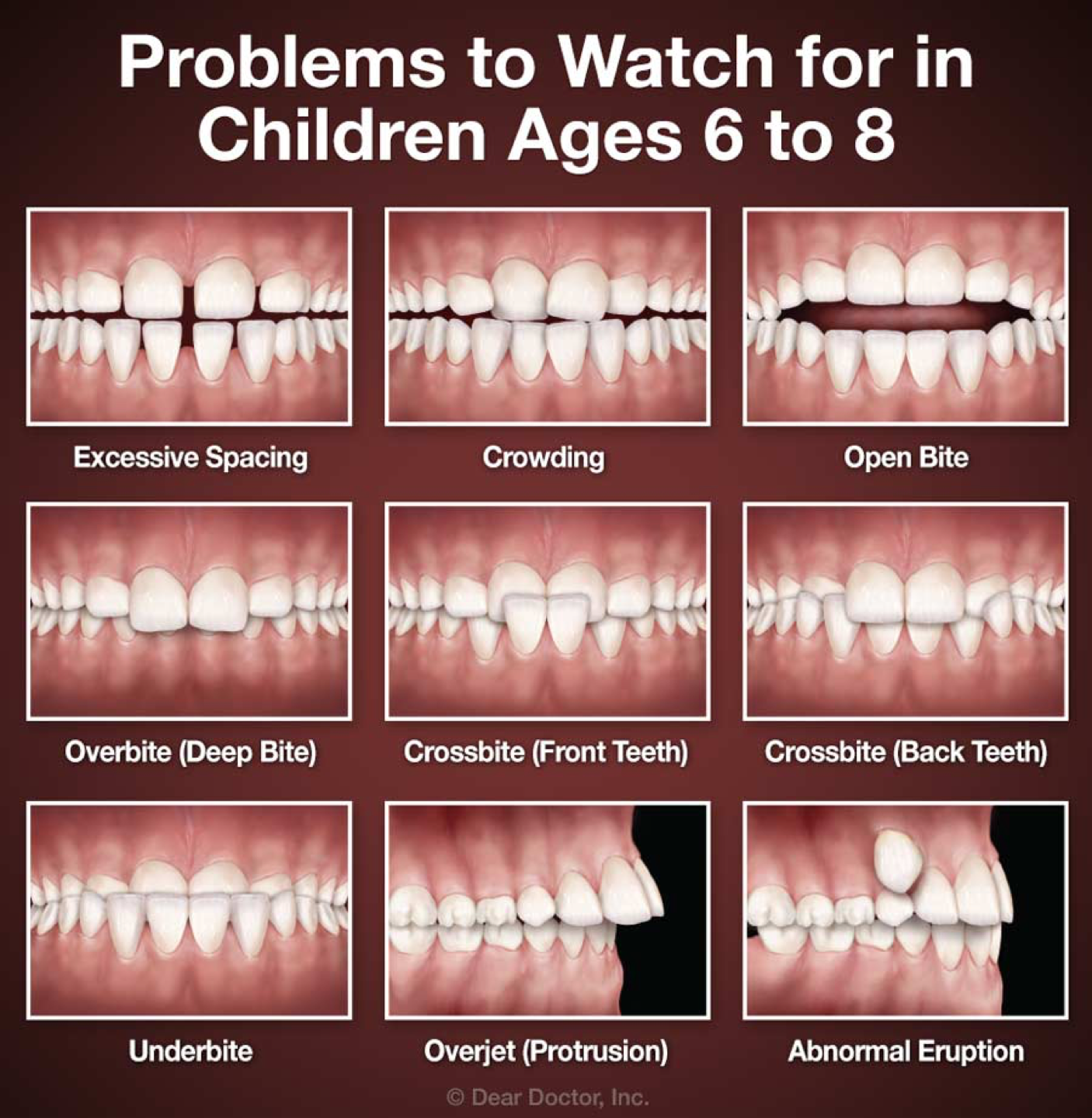 Early Treatment for teeth