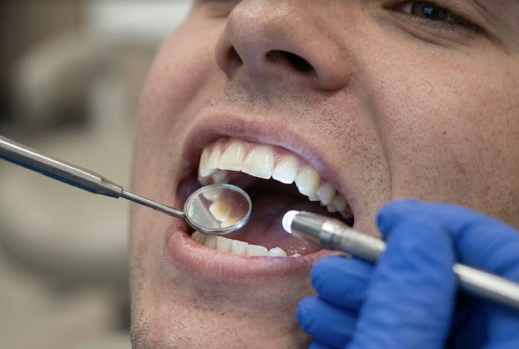 Benefit 5: Reduced Sources of Uneven Tooth Wear